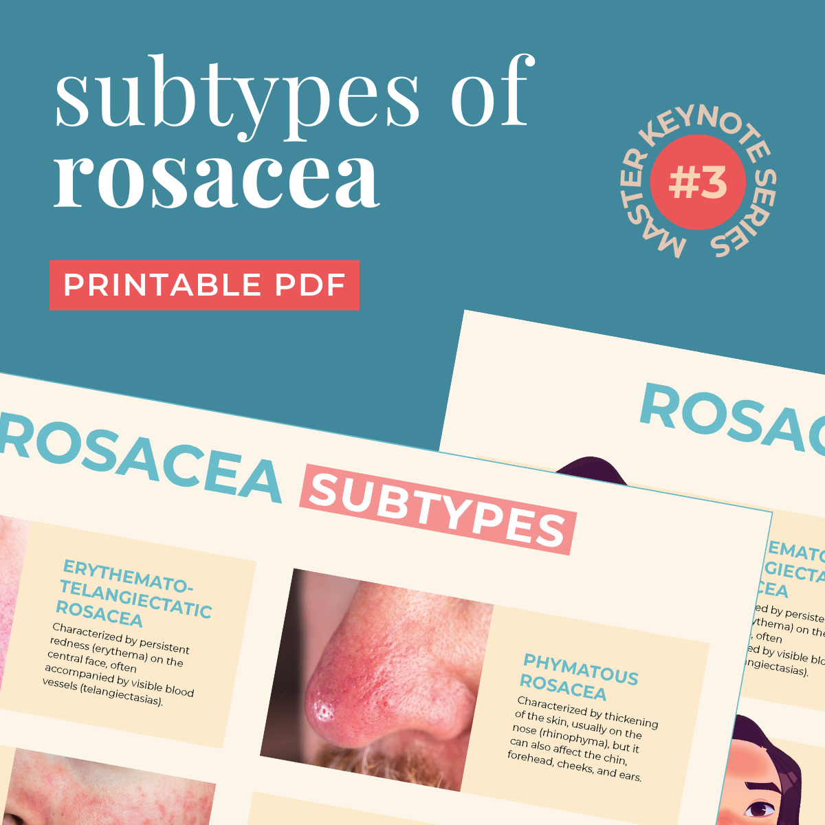 MKS003 – 'Understanding Rosacea' Resources