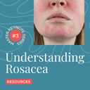 MKS003 – 'Understanding Rosacea' Resources