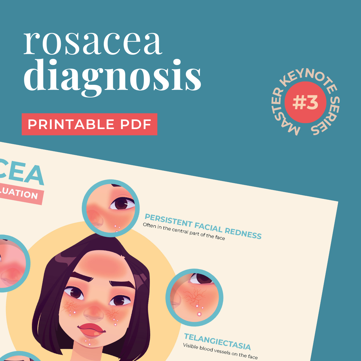 MKS003 – 'Understanding Rosacea' Resources